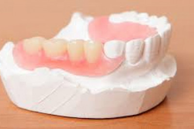 All You  Need To Know About Dental Veneers