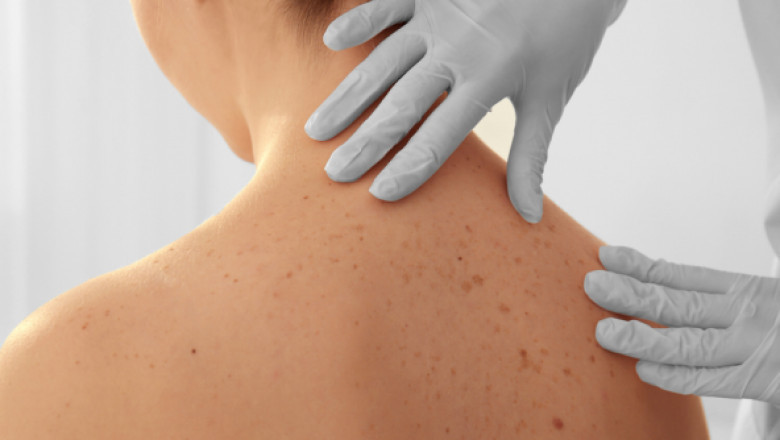 Dermatologists near me in Venice