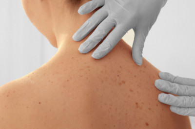 Dermatologists near me in Venice