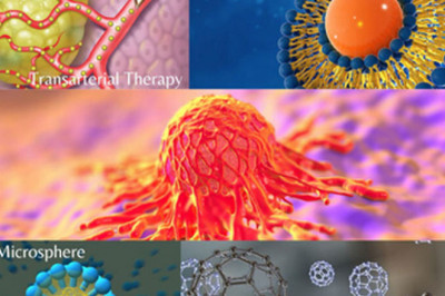 Drug delivery in cancer Market 2021 Industry Analysis by Top Leading Player, Key Regions, Future Demand and Forecast upto 2028