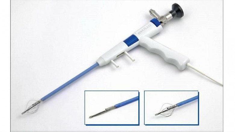 Global Endometrial Ablation Market – Industry Trends and Forecast to 2026