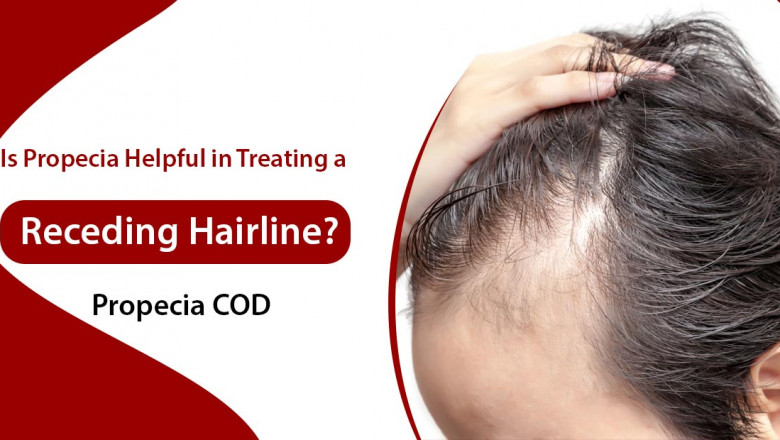How to use Propecia for receding hairline treatment in men?