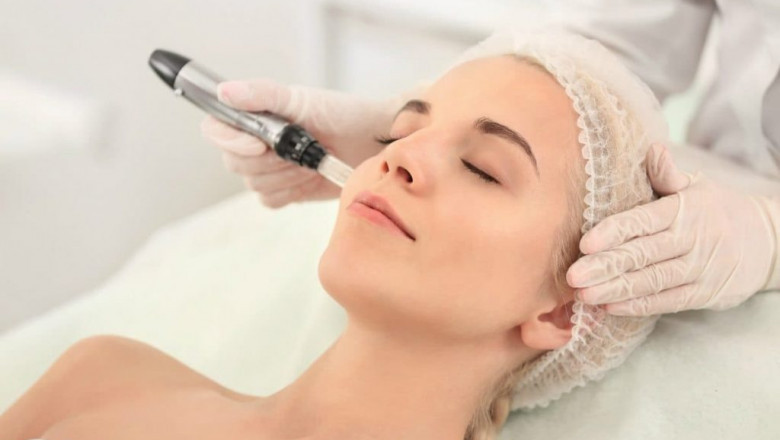 Microneedling: Health Benefits and Risks