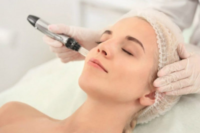 Microneedling: Health Benefits and Risks