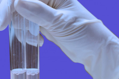 Acetic Acid Market Size, Share, Trends, Growth, Industry Report and Forecast 2030 - ChemAnalyst