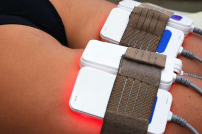 Everything You Need To Know About Lipo Laser