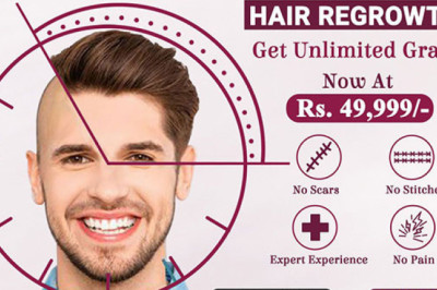 Hair Transplantation Treatment in Hyderabad