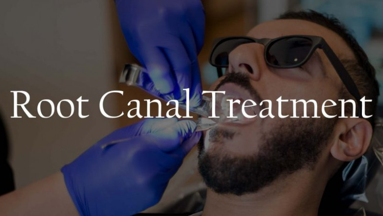 How Dental Veneers Can Enhance Your Look?
