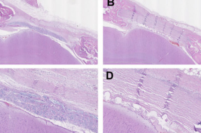 Biological Dural Repair Market 2021 Recent Development, Covid-19 Effect Analysis by Top Companies and Forecast 2028