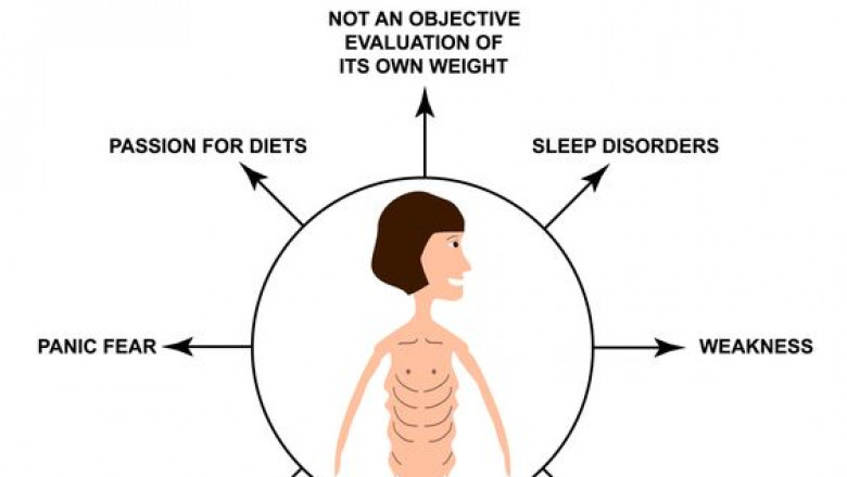 Best Dietician In India | Suffering From Anorexia