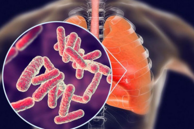 How Tuberculosis Drugs Spreads