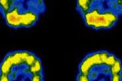 SPECT and SPECT-CT Market Growth Research 2021 by Global Industry Size, Demands, regions, Opportunity and Share Forecast to 2026