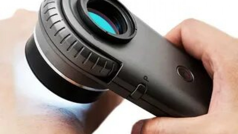Dermatoscope Market Study Overview, Minor Issues, Clinical Assessments and Diagnostic Application Forecast to 2026