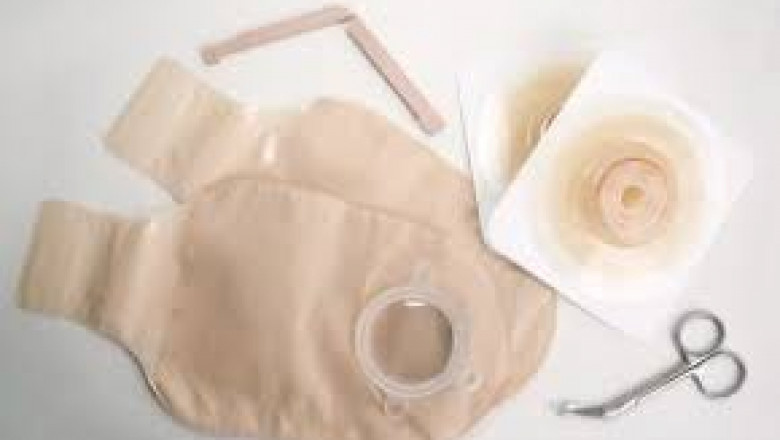 Disposable Ostomy Bags Market In-Depth Analysis, Significant Growth, Top Companies Data, Forecast to 2026