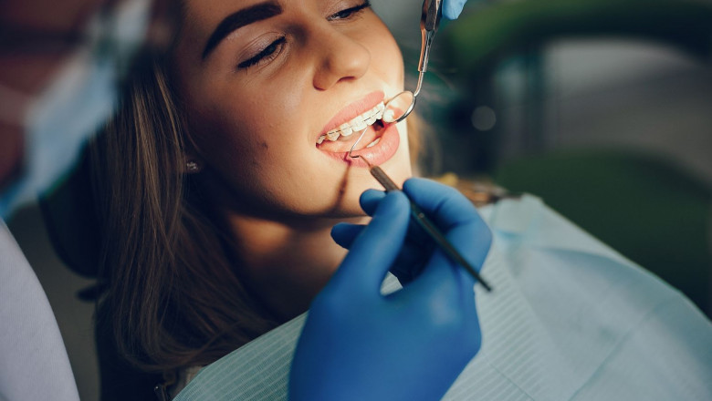 Everything About Periodontal Treatment