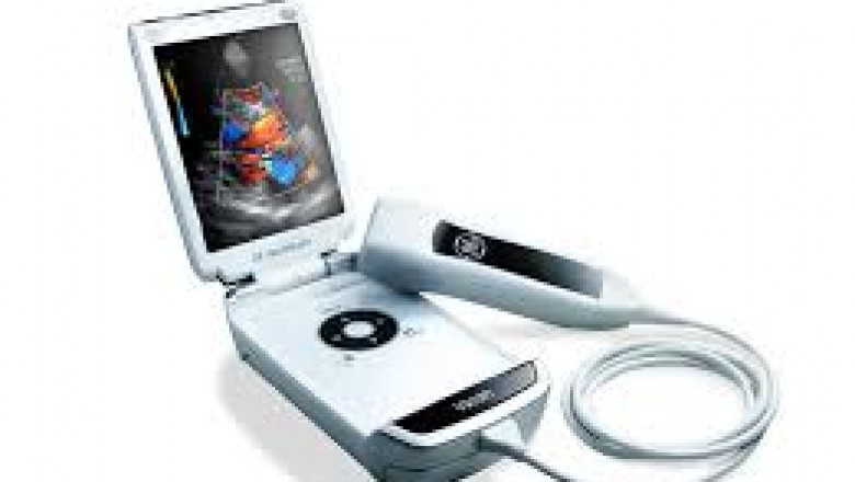 Ultrasound Market Growth Analysis, Top Manufactures,Explosive Trends,and Share Forecast to 2026