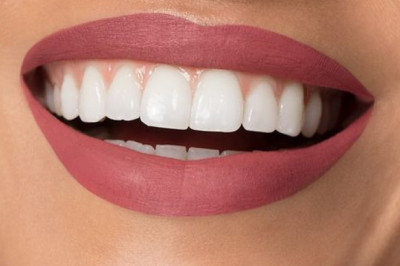 Different Methods Of Teeth Whitening