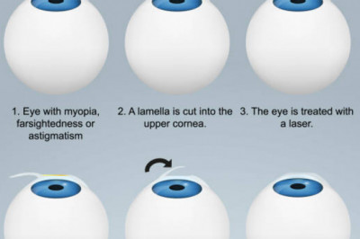 Does Lasik treatment affects your vision? Is it the best treatment option available?