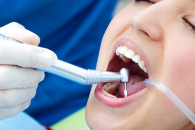 Are Dental Implants a Permanent Solution to Missing Teeth?