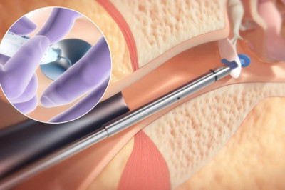 Ear Tube Devices Market 2021 Key Drivers and Restraints, Regional Outlook, End-User Applicants by 2028