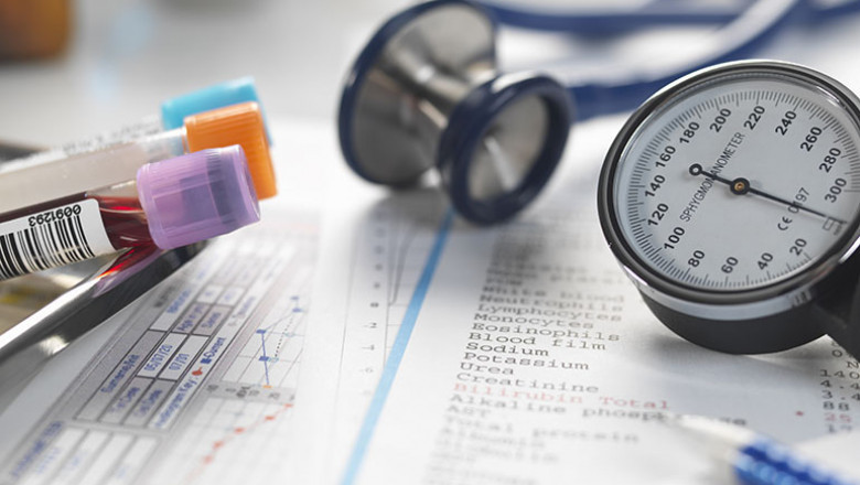 Lactate dehydrogenase Test Market Rising Trends, Industry Analysis and Demands 2021 to 2028