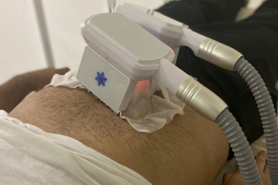 The Whole Truth About Fat Freezing