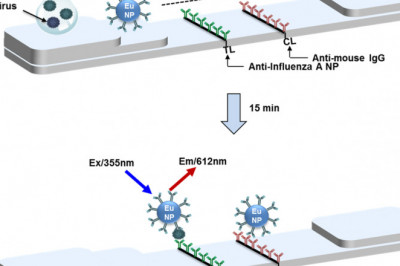 Viral Antigen Diagnostics Market 2021 - Industry Segment, Drivers, Trends, Forecast to 2028