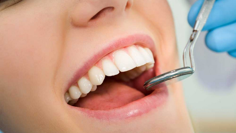 What Are Some Frequently Asked Questions About Invisalign?