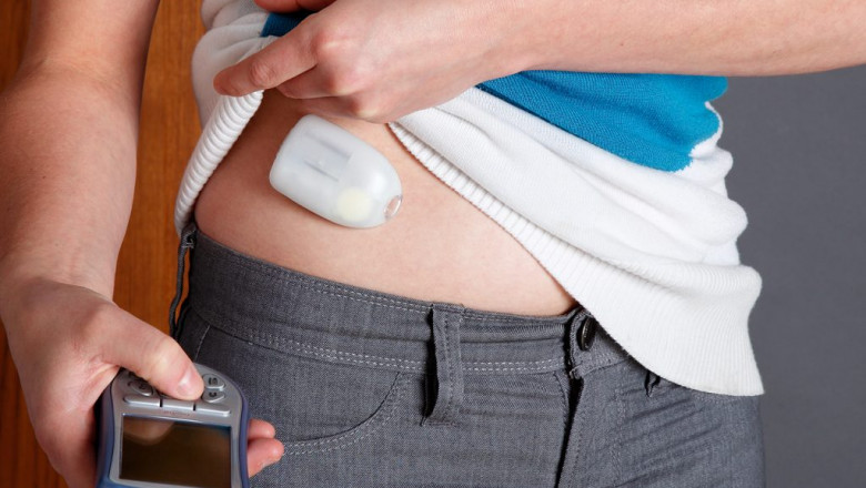 Disposable Insulin Pumps Market 2021: Challenges, Drivers, Analysis, Industry Share and Forecast 2028