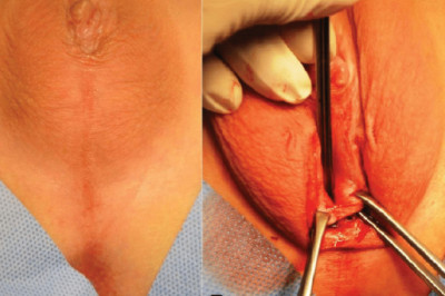 Partial Androgen Insensitivity Syndrome Market 2021 - Business Strategies, Product Sales and Growth Rate, Assessment to 2028