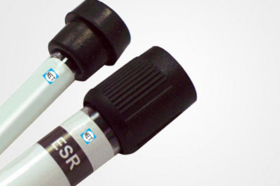 What is a normal ESR Tubes level?