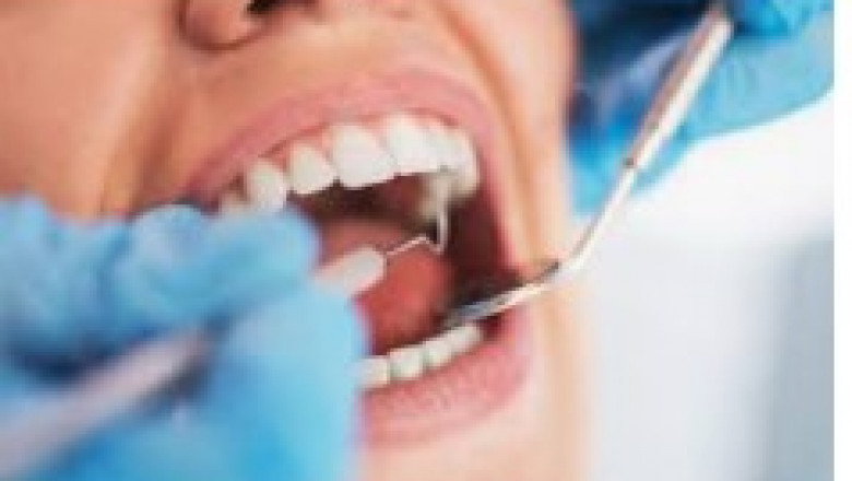 Why Should You Consider Using Clear Aligners to Get a Brighter Smile?