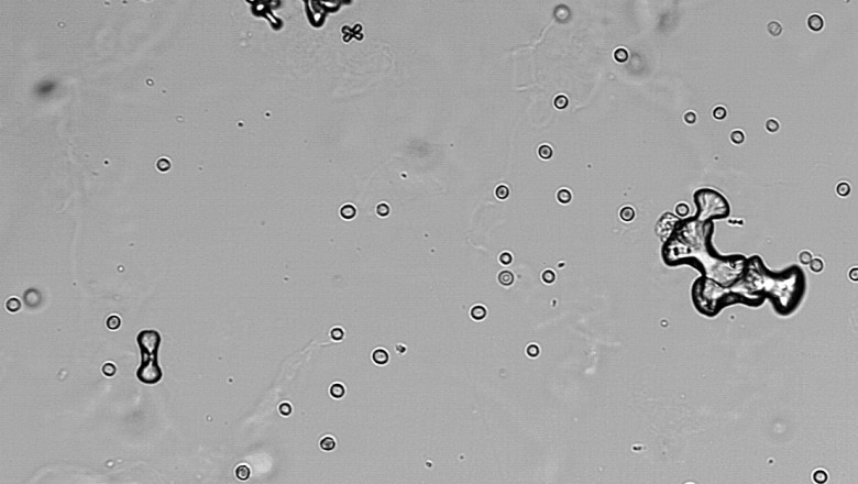Calcium Oxalate Market Industry Trends, Demands and Growth Analysis 2021 to 2026