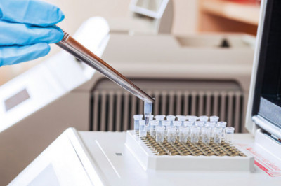 Specimen Validity Testing  Market 2022 Growth, Latest Trend Analysis and Forecast 2028