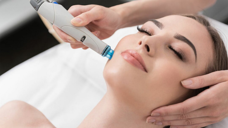 What Is a HydraFacial and How Does It Work?