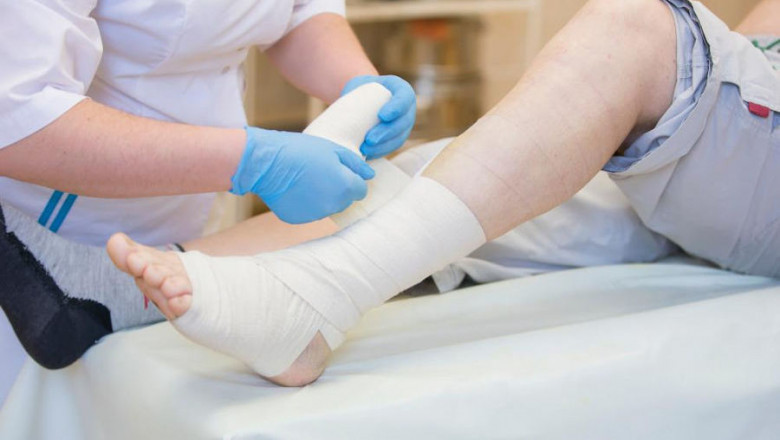 Appropriate Wound Care can help in Preventing Leg Amputation