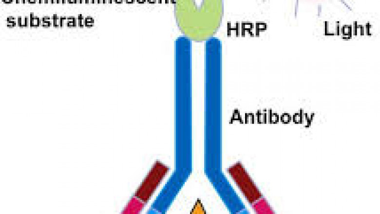 Chemiluminescence Immunoassay Market 2022 Industry Size, Segments, Share, Key Players and Growth Factor Analysis by 2026