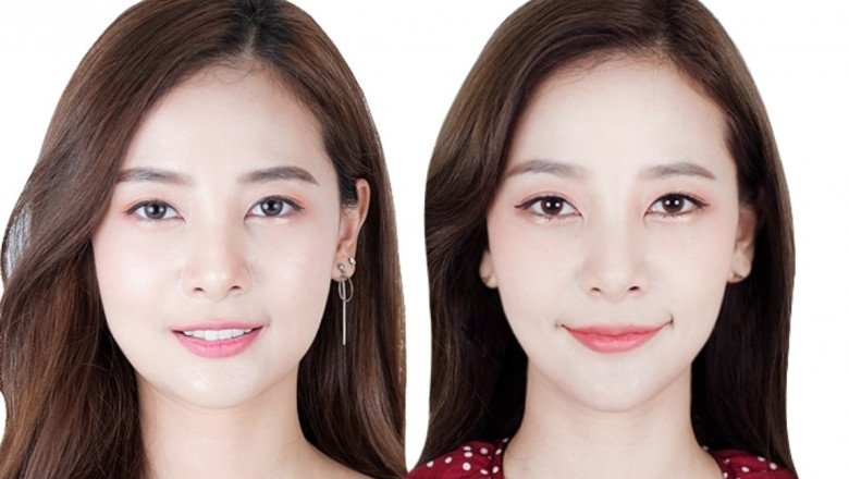 Botox Injections - What to Count on at Your Botox Go to