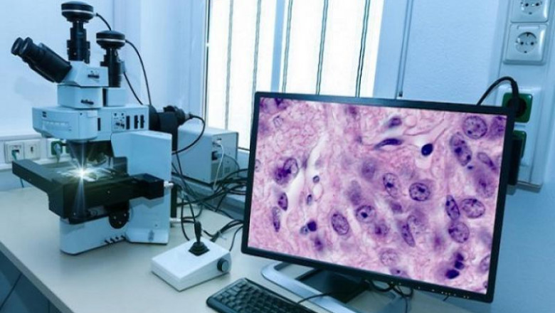 Digital Pathology Market Revenue, Trends, Market Share Analysis, and Forecast to 2028