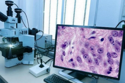Digital Pathology Market Revenue, Trends, Market Share Analysis, and Forecast to 2028