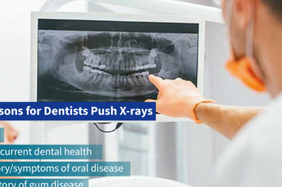 Reasons for Dentists Push X-rays | Emergency Dental Care