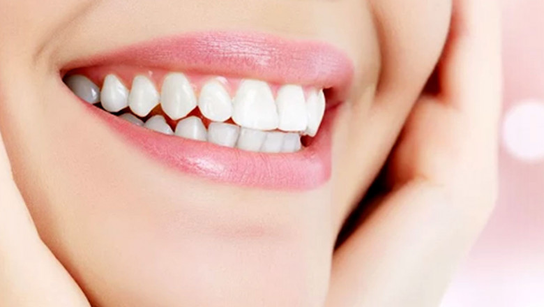 Tips For Teeth Whitening