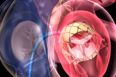 Transcatheter Pulmonary Valve Market 2022 Regional Overview, Leading Company Analysis, Opportunities, and Forecast to 2029