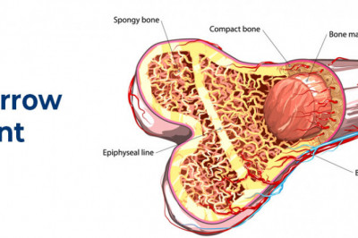Bone Marrow Transplant Market Trend, Forecast, Drivers, Restraints, Company Profiles and Key Players Analysis by 2027