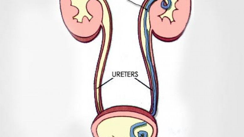 Ureteral Stents Market - Global Industry Analysis, Size, Share, Growth, Trends, and Forecast 2016 – 2026