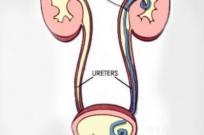 Ureteral Stents Market - Global Industry Analysis, Size, Share, Growth, Trends, and Forecast 2016 – 2026