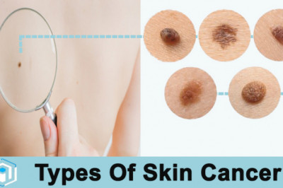 Types Of Skin Cancer | Pictures Of Skin Cancer