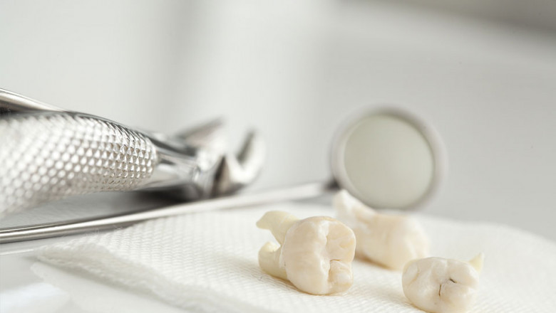 What Are the Dental Crowns?