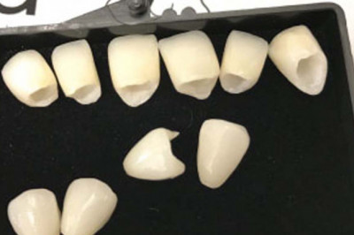 Points Which Need To Be Considered While Having Teeth Whitening Kits