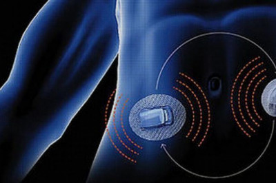 Artificial Pancreas Device System Market Key Trends